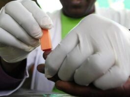  الكوليرا تقتل 70 شخصًا في السودان وإصابة أكثر من 2200