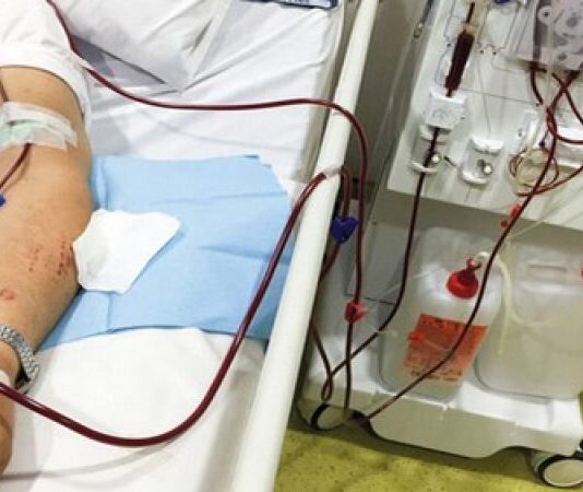 أمراض الكلى في تونس: 1500 مريض ينتظرون متبرّعًا والأرقام تنذر بالخطر