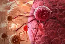 5 أعراض شائعة للسرطان قد يتجاهلها كثيرون