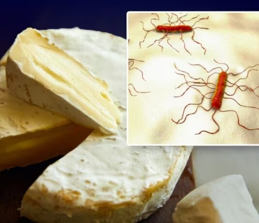 فضيحة صحية: أجبان فرنسية ملوثة بالليستيريا تصل إلى 32 دولة