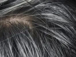 6 أطعمة لمنع ظهور الشيب المبكر