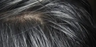 6 أطعمة لمنع ظهور الشيب المبكر