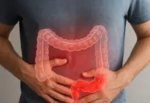 Symptômes précoces du cancer de l’intestin : Un guide pour une détection rapide أعراض مبكرة سرطان الأمعاء ثقل بطن إمساك تعب