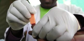  الكوليرا تقتل 70 شخصًا في السودان وإصابة أكثر من 2200