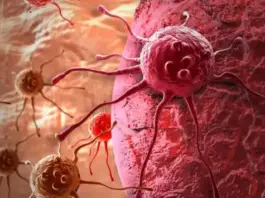 5 أعراض شائعة للسرطان قد يتجاهلها كثيرون