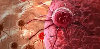 5 أعراض شائعة للسرطان قد يتجاهلها كثيرون