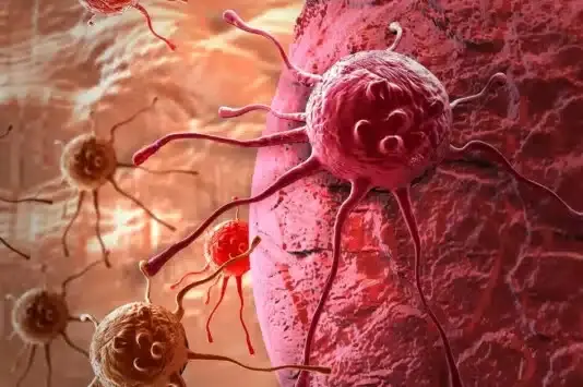 5 أعراض شائعة للسرطان قد يتجاهلها كثيرون