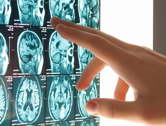 إطار طبي في قسم الاستعجال يعتني بمريض مصاب بالجلطة الدماغية داخل مستشفى تونسي