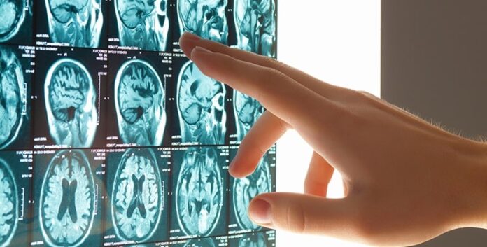 إطار طبي في قسم الاستعجال يعتني بمريض مصاب بالجلطة الدماغية داخل مستشفى تونسي